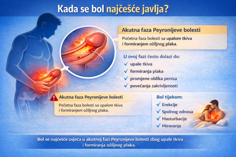 Bol u akutnoj fazi Peyronijeve bolesti